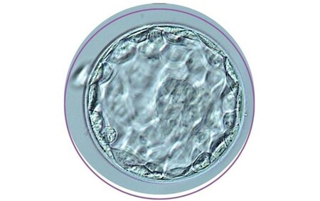 Embryo Grading 