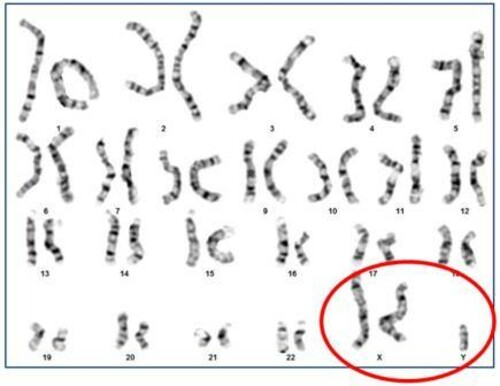 chromosome_anbormality.jpg