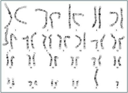 karyotype.jpg